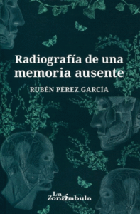 Radiografía de una memoria ausente
